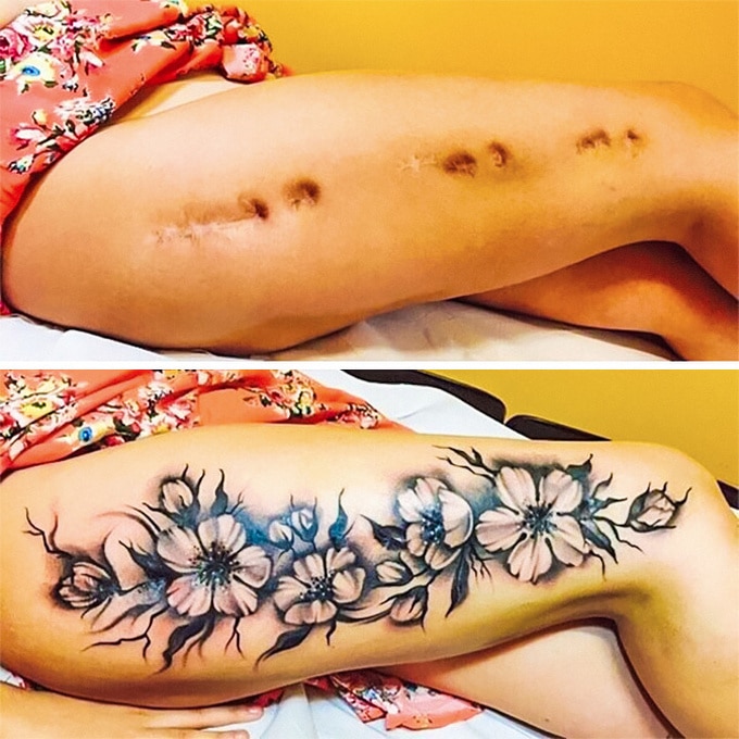 21 tatuagens que transformam cicatrizes em obras de arte 4