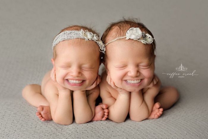 E se os bebês nascessem com dentes? (16 fotos) 3