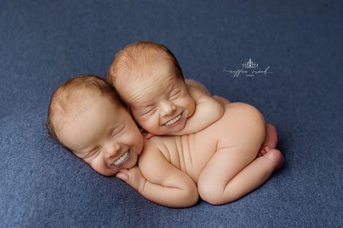 E se os bebês nascessem com dentes? (16 fotos) 14