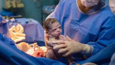 Bebê zangada que viralizou na internet 25