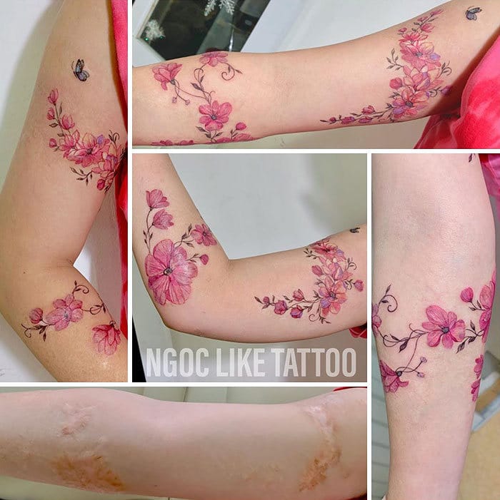 30 pessoas que pediram para encobrir suas cicatrizes com tatuagem 2