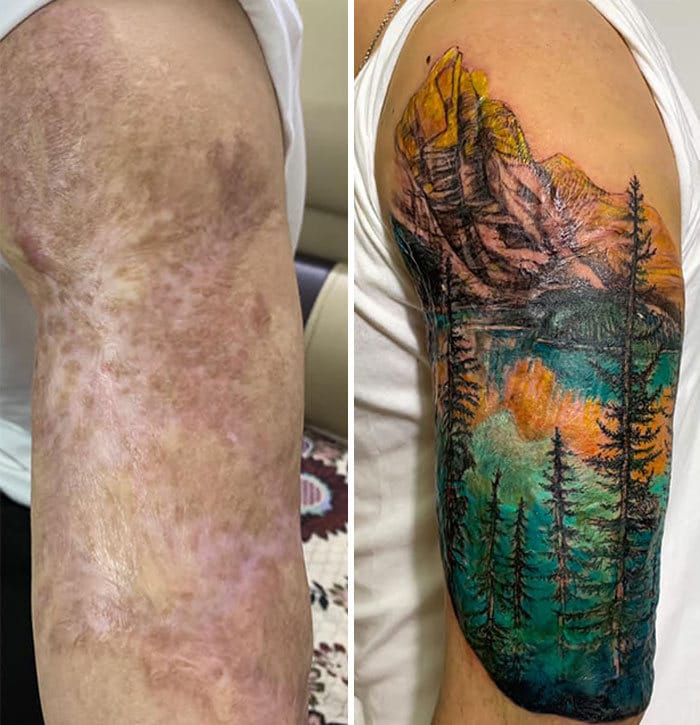 30 pessoas que pediram para encobrir suas cicatrizes com tatuagem 4