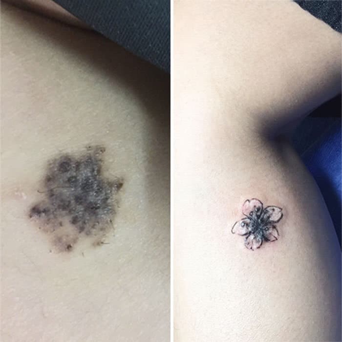 30 pessoas que pediram para encobrir suas cicatrizes com tatuagem 6
