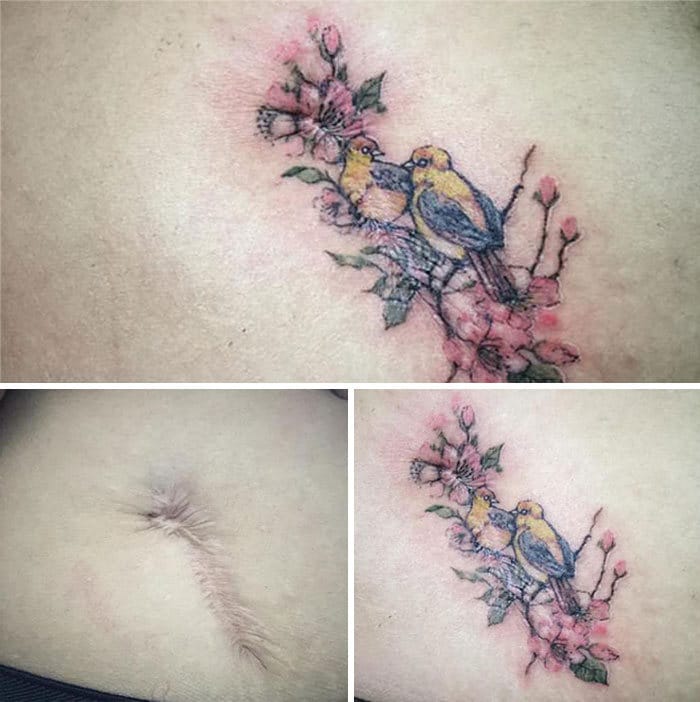 30 pessoas que pediram para encobrir suas cicatrizes com tatuagem 8