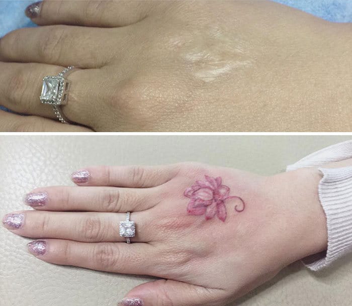 30 pessoas que pediram para encobrir suas cicatrizes com tatuagem 10