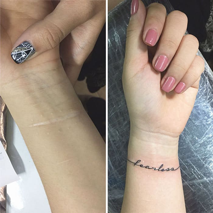 30 pessoas que pediram para encobrir suas cicatrizes com tatuagem 11