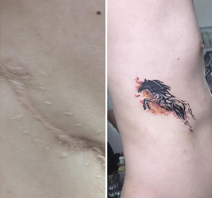 30 pessoas que pediram para encobrir suas cicatrizes com tatuagem 12