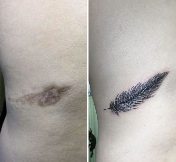 30 pessoas que pediram para encobrir suas cicatrizes com tatuagem 14