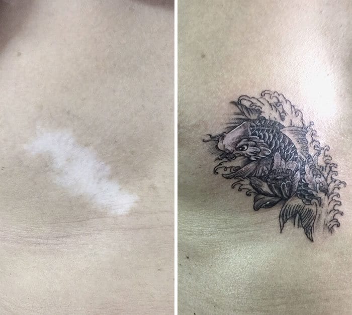 30 pessoas que pediram para encobrir suas cicatrizes com tatuagem 17