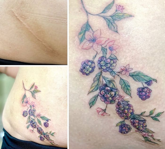 30 pessoas que pediram para encobrir suas cicatrizes com tatuagem 19