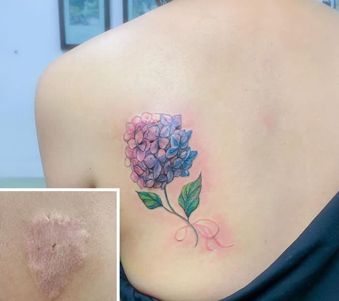30 pessoas que pediram para encobrir suas cicatrizes com tatuagem 20