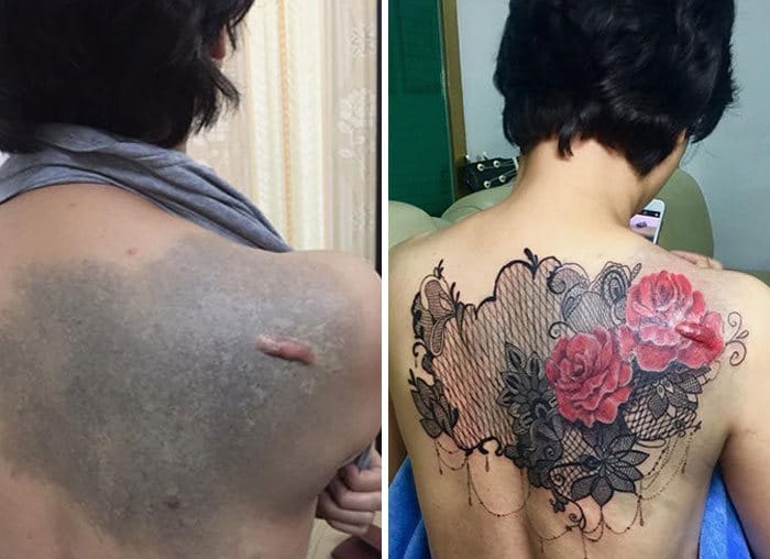 30 pessoas que pediram para encobrir suas cicatrizes com tatuagem 25