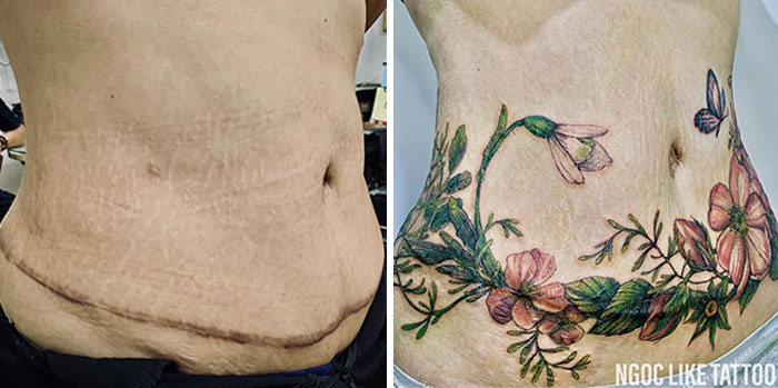 30 pessoas que pediram para encobrir suas cicatrizes com tatuagem 27