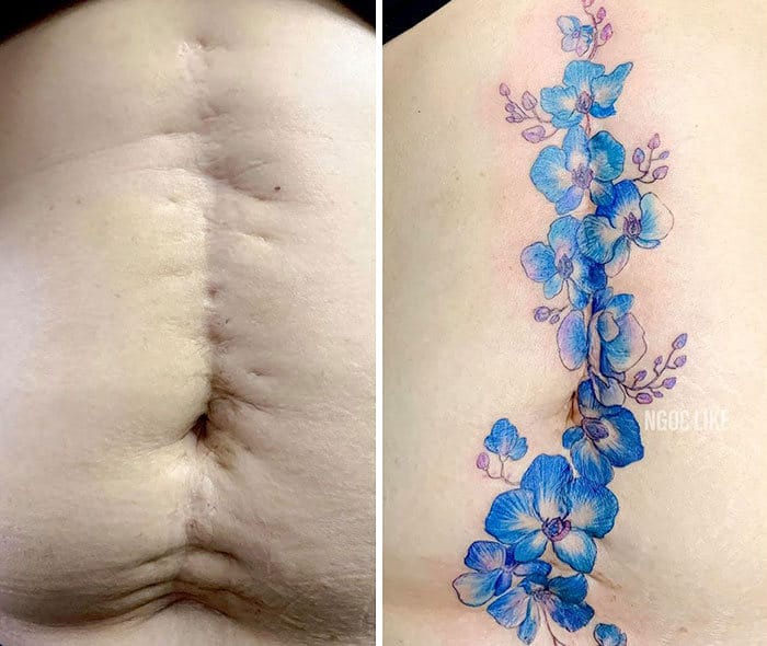 30 pessoas que pediram para encobrir suas cicatrizes com tatuagem 28