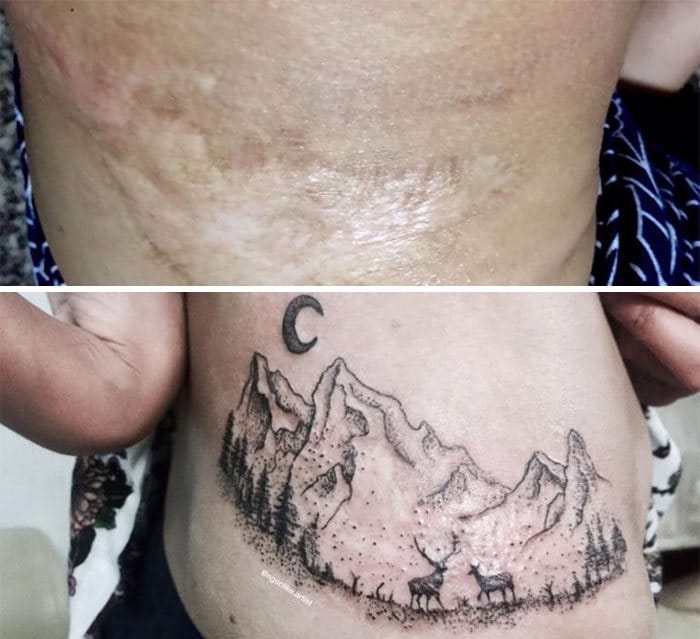 30 pessoas que pediram para encobrir suas cicatrizes com tatuagem 29
