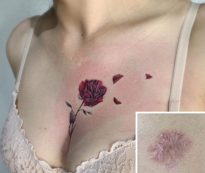 30 pessoas que pediram para encobrir suas cicatrizes com tatuagem 30