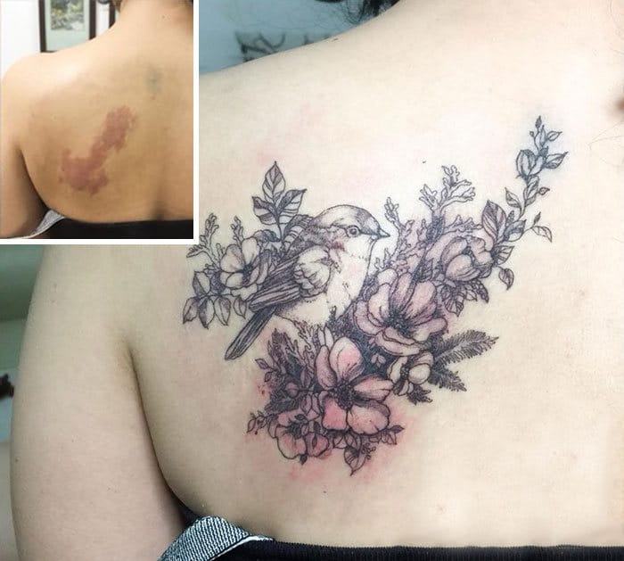 30 pessoas que pediram para encobrir suas cicatrizes com tatuagem 31