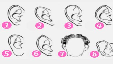 Qual é o formato de suas orelhas? 1