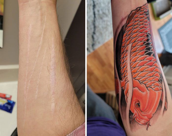 46 tatuagens incríveis que transformaram cicatrizes e marcas de nascença em obras de arte 18