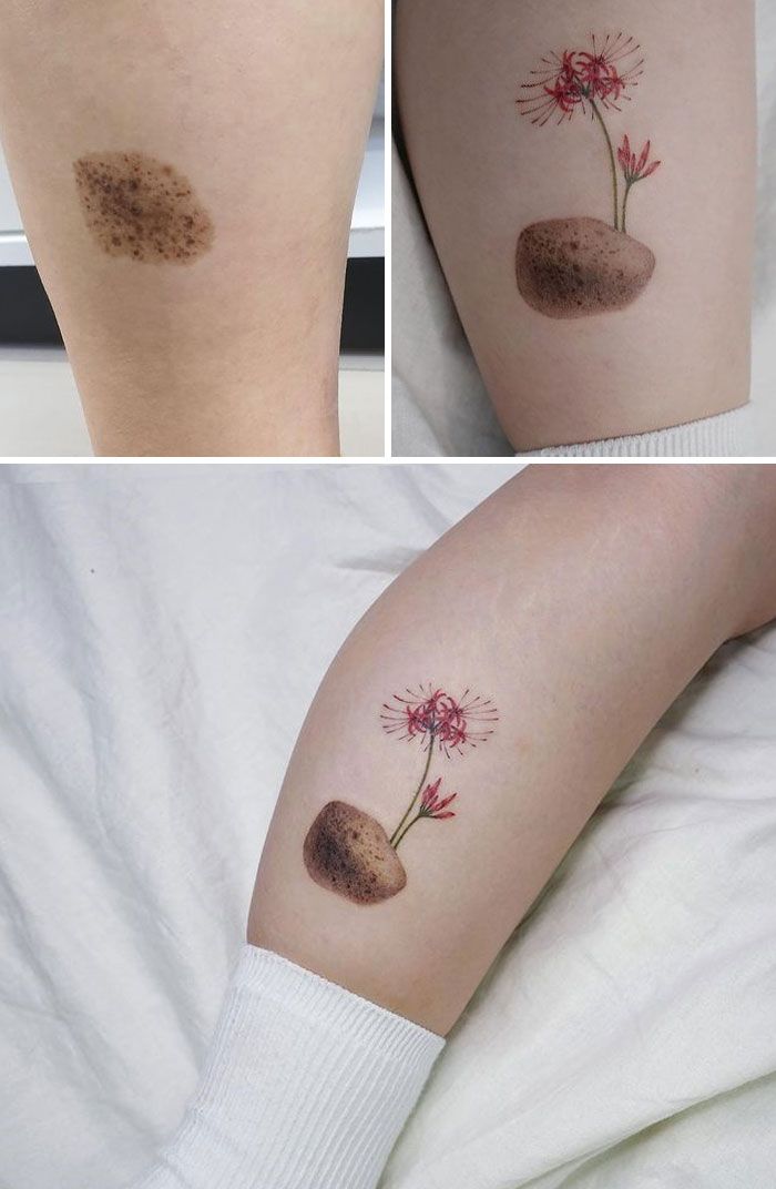 46 tatuagens incríveis que transformaram cicatrizes e marcas de nascença em obras de arte 23