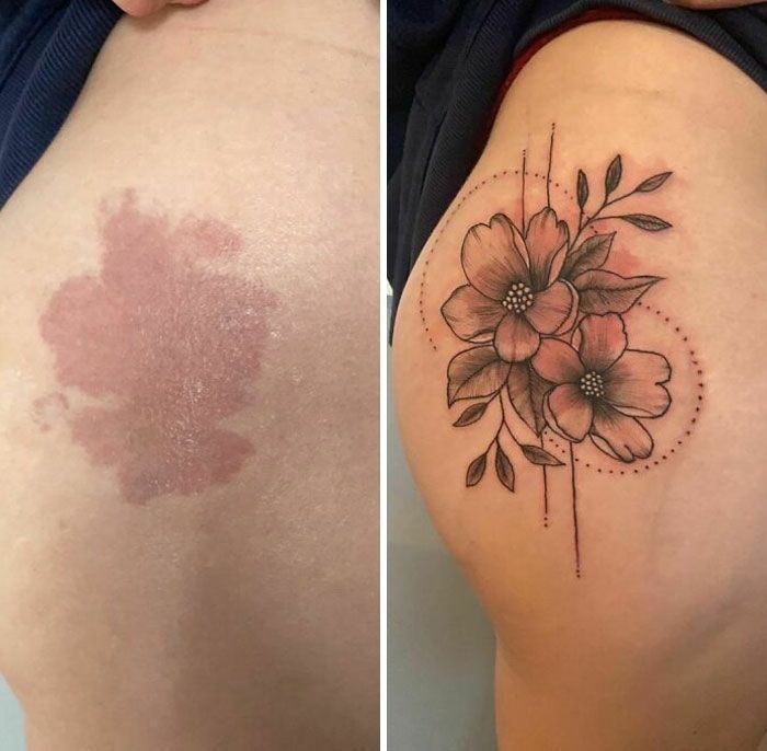 46 tatuagens incríveis que transformaram cicatrizes e marcas de nascença em obras de arte 25