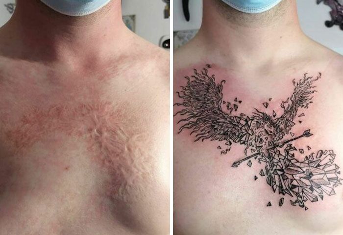 46 tatuagens incríveis que transformaram cicatrizes e marcas de nascença em obras de arte 26