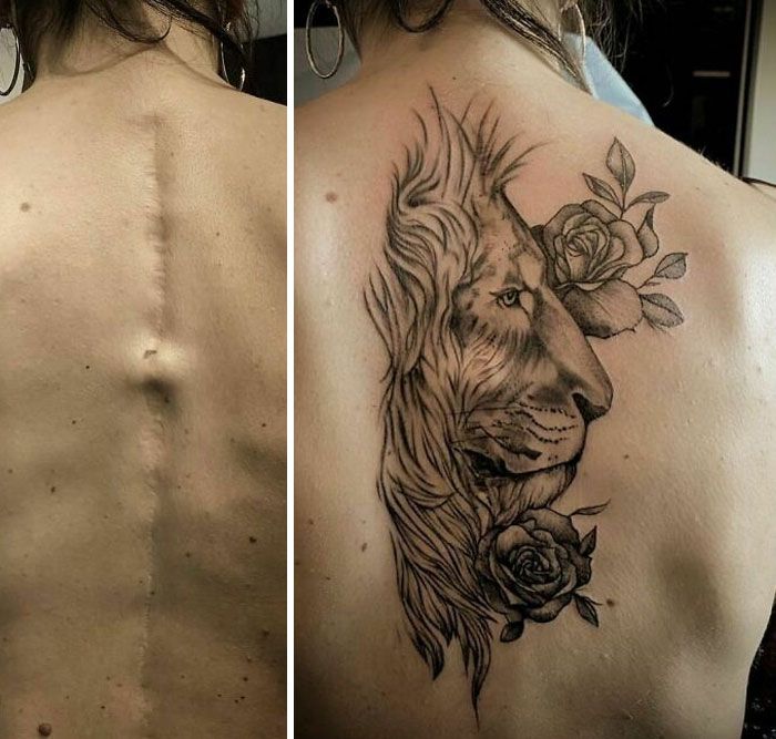 46 tatuagens incríveis que transformaram cicatrizes e marcas de nascença em obras de arte 27