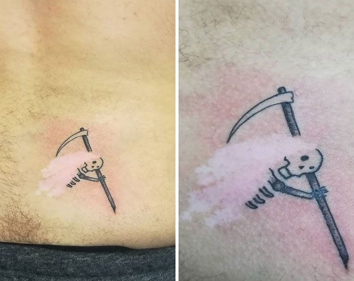 46 tatuagens incríveis que transformaram cicatrizes e marcas de nascença em obras de arte 29
