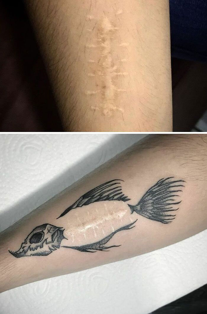 46 tatuagens incríveis que transformaram cicatrizes e marcas de nascença em obras de arte 31