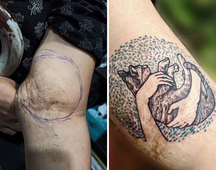 46 tatuagens incríveis que transformaram cicatrizes e marcas de nascença em obras de arte 35