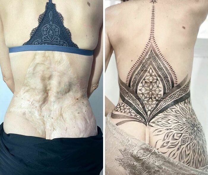 46 tatuagens incríveis que transformaram cicatrizes e marcas de nascença em obras de arte 37
