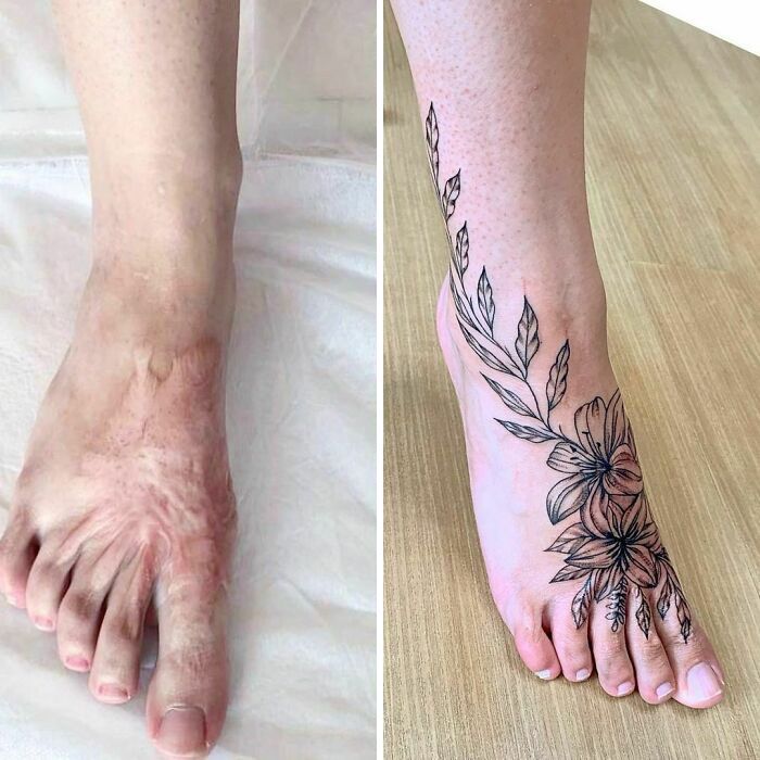46 tatuagens incríveis que transformaram cicatrizes e marcas de nascença em obras de arte 39