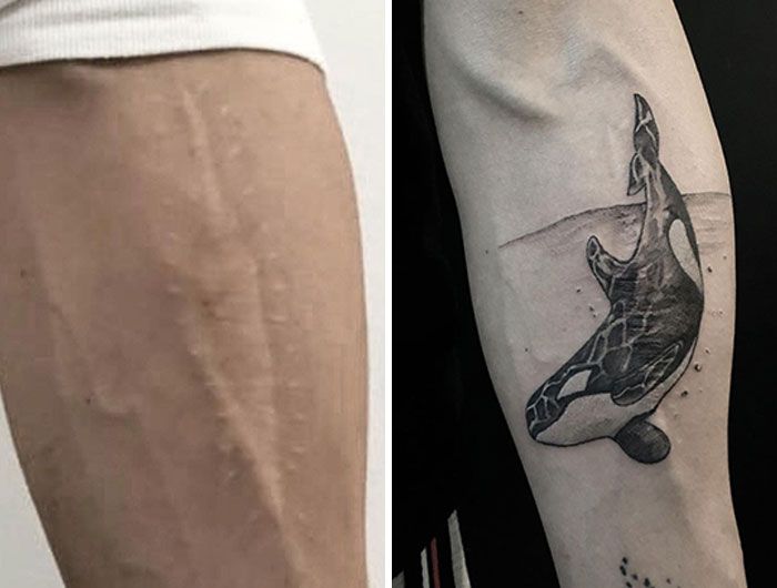 46 tatuagens incríveis que transformaram cicatrizes e marcas de nascença em obras de arte 40