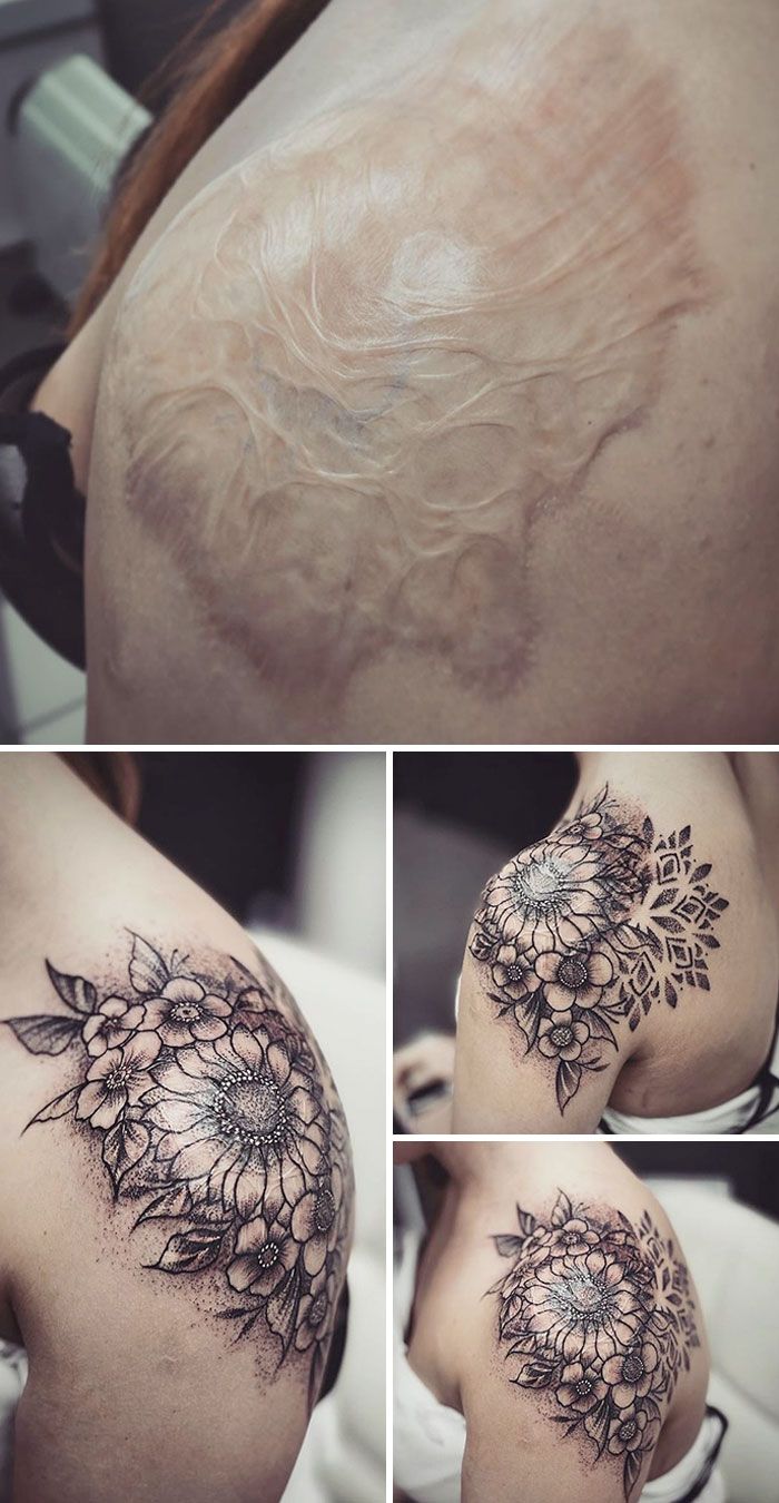 46 tatuagens incríveis que transformaram cicatrizes e marcas de nascença em obras de arte 41
