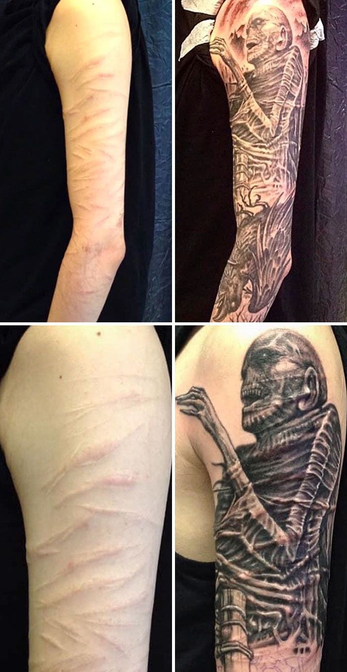 46 tatuagens incríveis que transformaram cicatrizes e marcas de nascença em obras de arte 42
