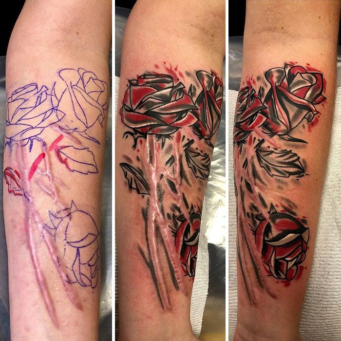 46 tatuagens incríveis que transformaram cicatrizes e marcas de nascença em obras de arte 45