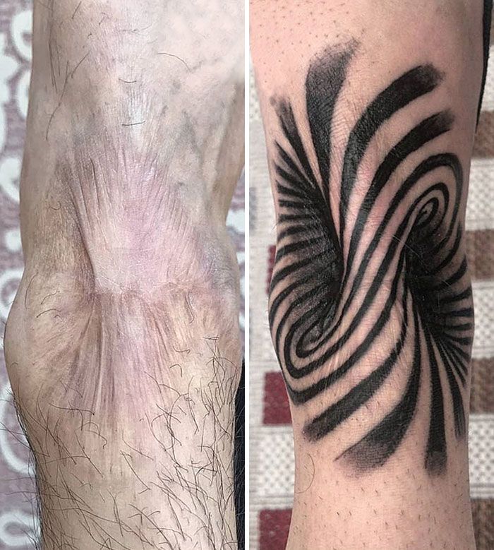 46 tatuagens incríveis que transformaram cicatrizes e marcas de nascença em obras de arte 46