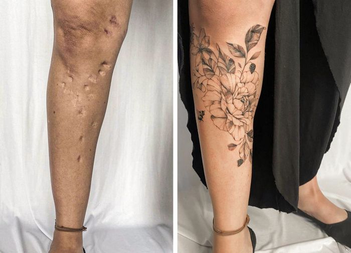 15 pessoas que recuperaram a confiança após transformar suas cicatrizes em tatuagem 9