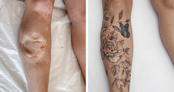 15 pessoas que recuperaram a confiança após transformar suas cicatrizes em tatuagem 14