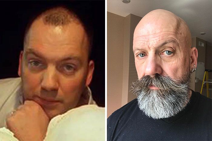 36 fotos antes e depois de homens que abandonaram as navalhas e deixaram suas barbas crescerem livremente 5