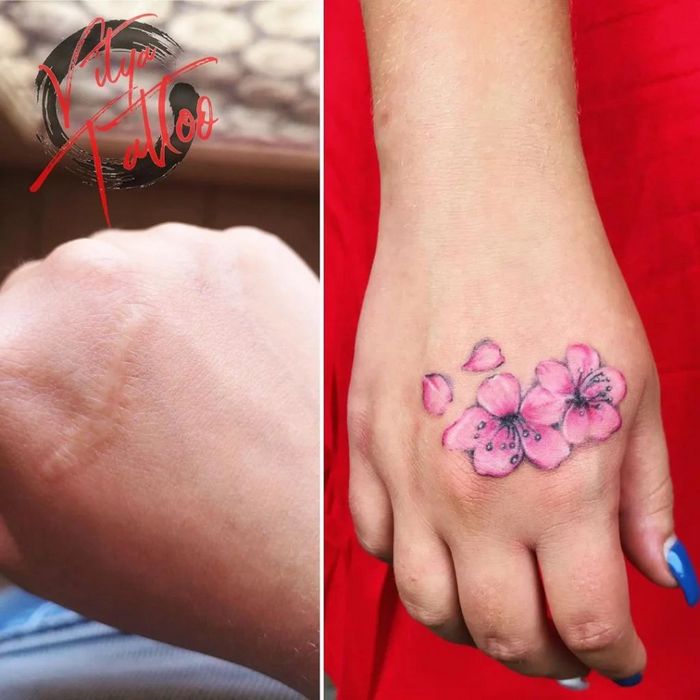 48 tatuagens incríveis que transformam marcas de nascença e cicatrizes em arte impressionante 11