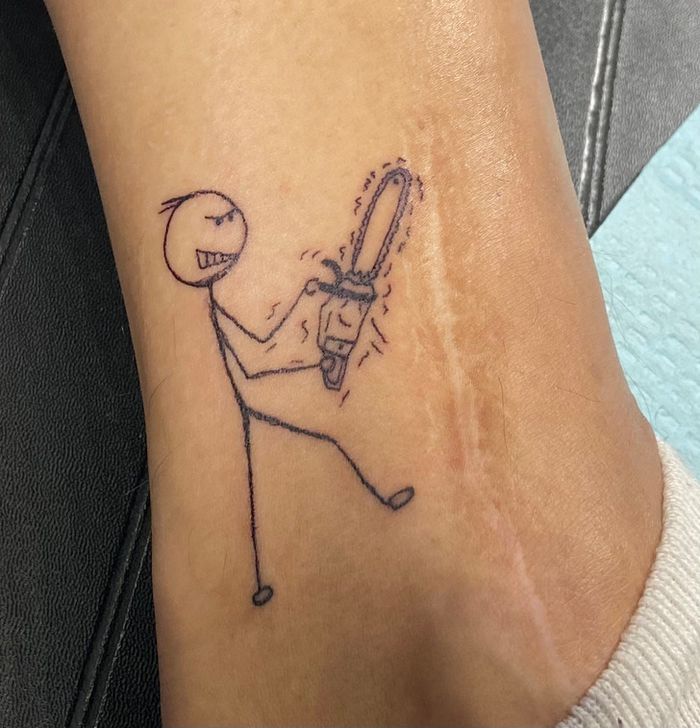 16 pessoas que usaram a arte das tatuagens para cobrir suas cicatrizes 2