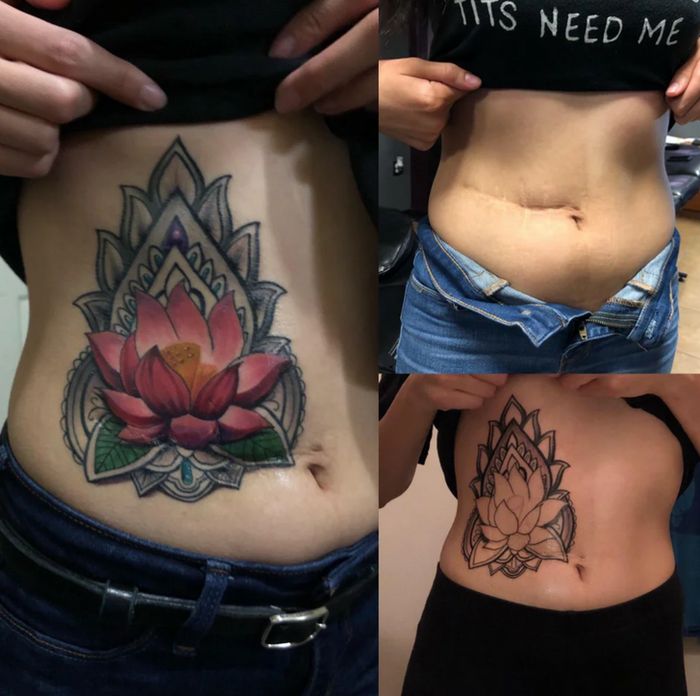 16 pessoas que usaram a arte das tatuagens para cobrir suas cicatrizes 7