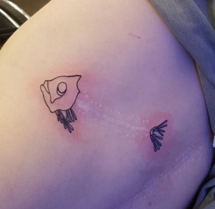 16 pessoas que usaram a arte das tatuagens para cobrir suas cicatrizes 9