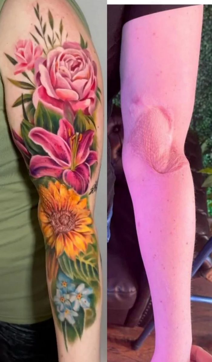 16 pessoas que usaram a arte das tatuagens para cobrir suas cicatrizes 11