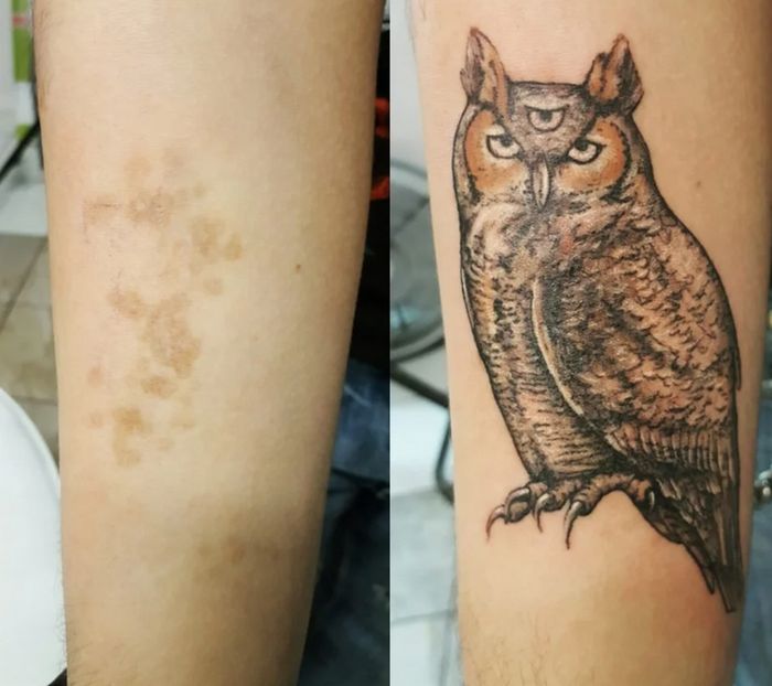 16 pessoas que usaram a arte das tatuagens para cobrir suas cicatrizes 12