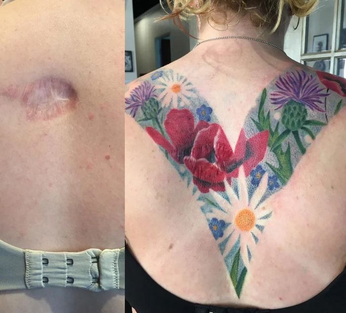 16 pessoas que usaram a arte das tatuagens para cobrir suas cicatrizes 14