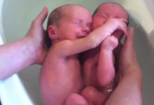 Bebês Gêmeos nascem e não percebem. Emocionante demais 10