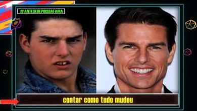 Antes de depois da fama #01 5