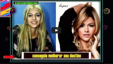 Antes de depois da fama #02 5